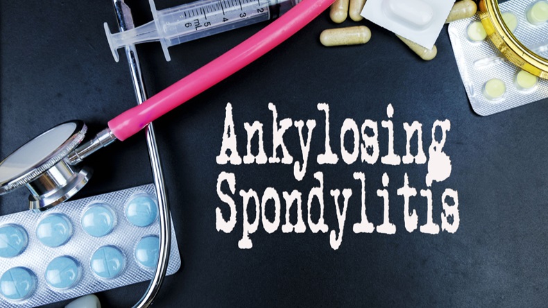 Ankylosing Spondylitis word, medical term word with medical concepts in blackboard and medical equipment - Image 