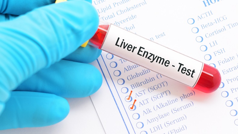 Blood sample with requisition form for liver enzyme (AST, ALT) test - Image 