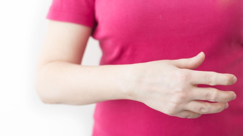 Young woman with rheumatoid arthritis deformed fingers