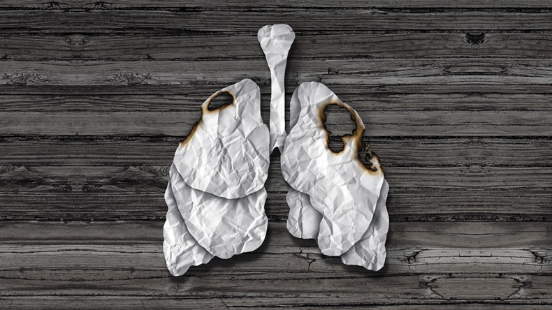 Lung cancer concept