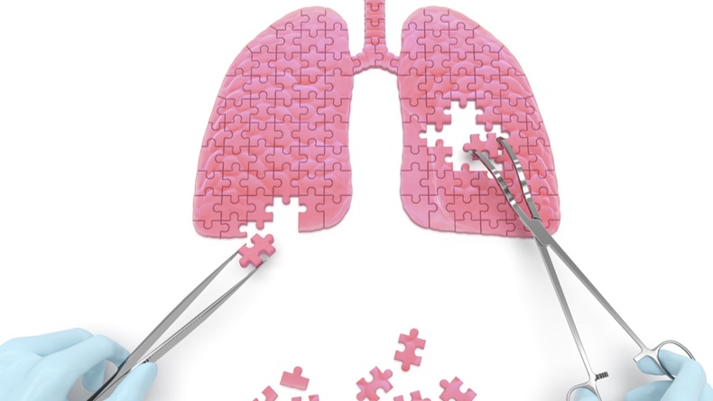 Lungs operation puzzle concept: hands of surgeon with surgical instruments (tools) perform lungs surgery as a result of respiratory disease, pneumonia, tuberculosis, bronchitis, asthma, lung abscess