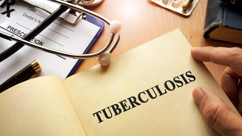 Tuberculosis concept with the word written on paper