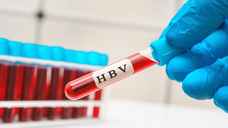 Tube with red liquid labelled 'HBV', hepatitis B blood test concept.