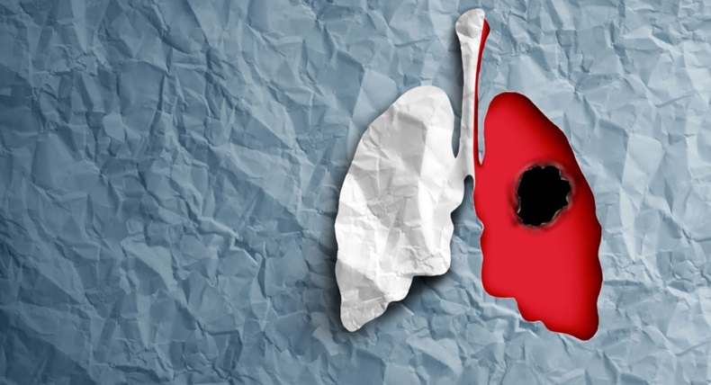Paper lungs with a hole on one side, depicting lung cancer, on blue background
