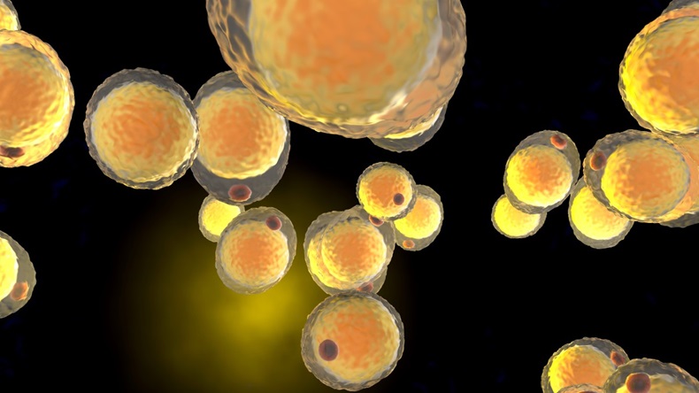 Small cream spheres representing lipoproteins