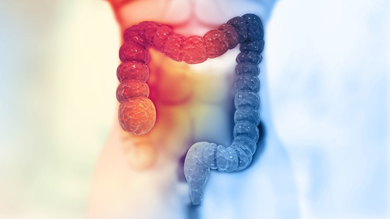 Red and blue colon highlighted in illustrated human body