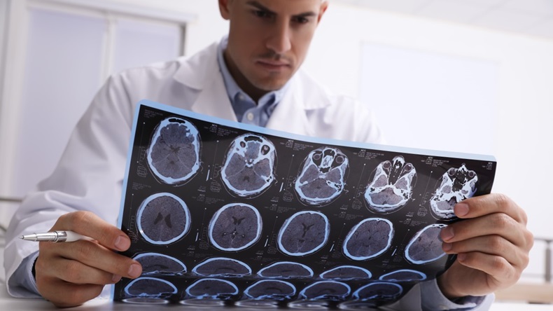 doctor holding mri brain scan images
