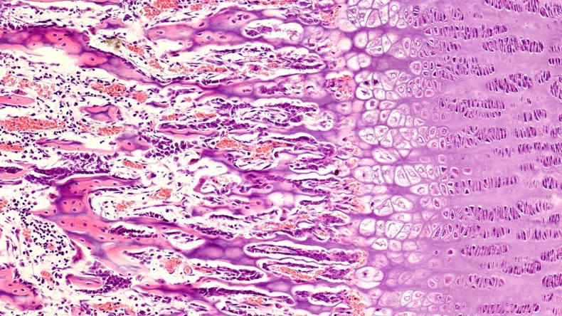 scan image of bone growth plate